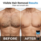 🥳2026 HOT SALE🥳💞50K+ SOLD! 🪒Men's Gentle Hair Removal Cream