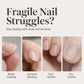 🔥LAST DAY SALE ONLY ￡7.99!!✨50K+ SOLD!🎁Garlic Nail Polish for Strengthening Brittle, Damaged Nails