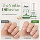 🔥LAST DAY SALE ONLY ￡7.99!!✨50K+ SOLD!🎁Garlic Nail Polish for Strengthening Brittle, Damaged Nails